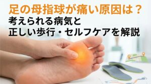 足の母指球が痛い原因は？考えられる病気と正しい歩行・セルフケアを解説